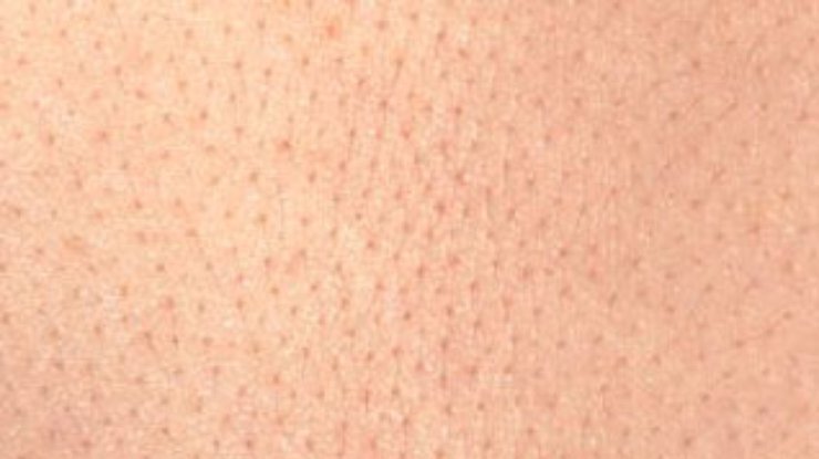 Новый тип искусственной кожи не отторгается организмом человека