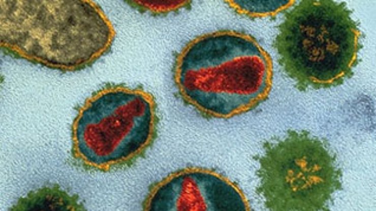 Ученые обнаружили ген, снижающий опасность ВИЧ