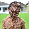 Тело пожилого индонезийца покрыли ужасные опухоли